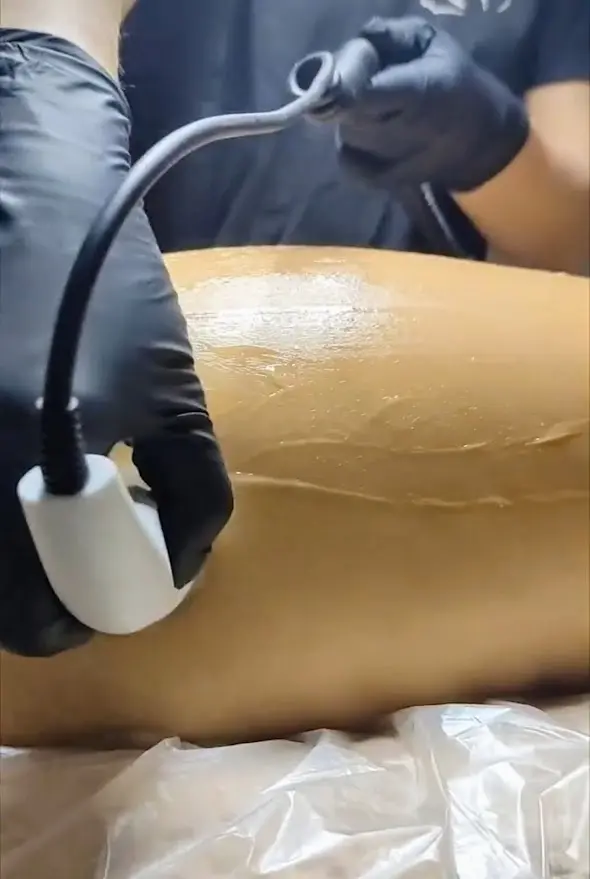 estética en Málaga